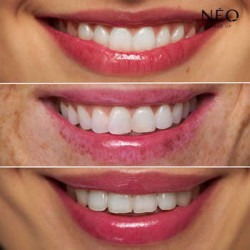 Intense Serum Magic Lip Oil Intense Serum Magic Lip Oil